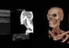 Visage Imaging lancia Visage Ease VP per Apple Vision Pro