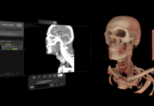 Visage Imaging lancia Visage Ease VP per Apple Vision Pro